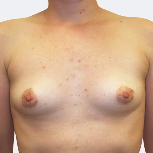 Image before