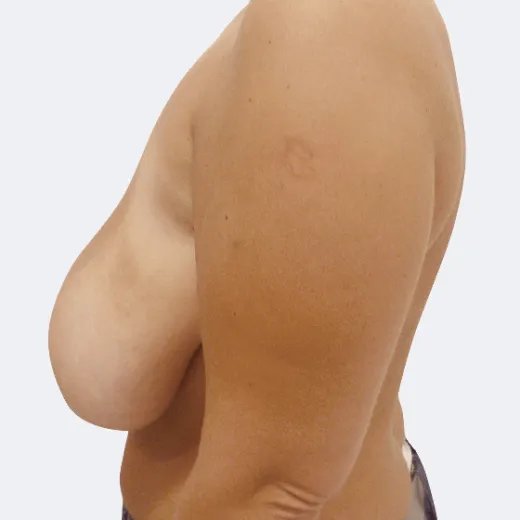 Image before